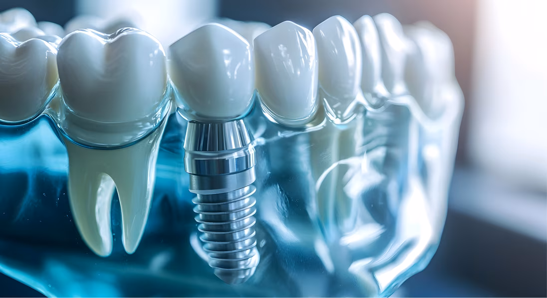 Athens Dental Care